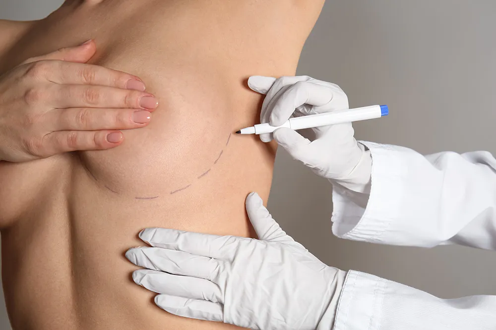 woman being prepped for breast lift surgery