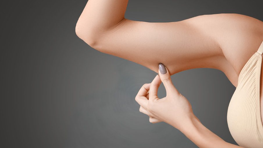 Arm Lift