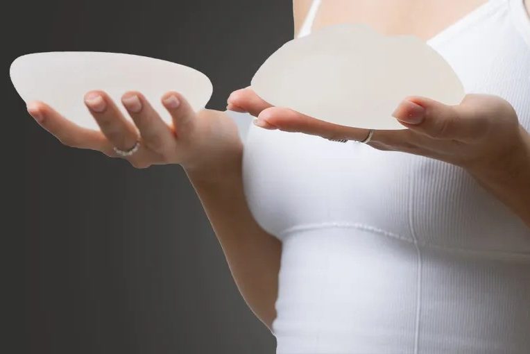 Breasts Lift with Implants