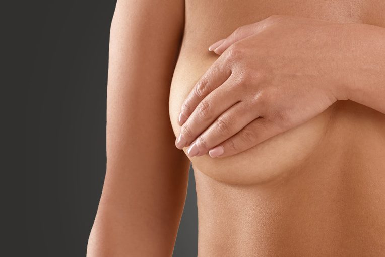 Breasts Lift