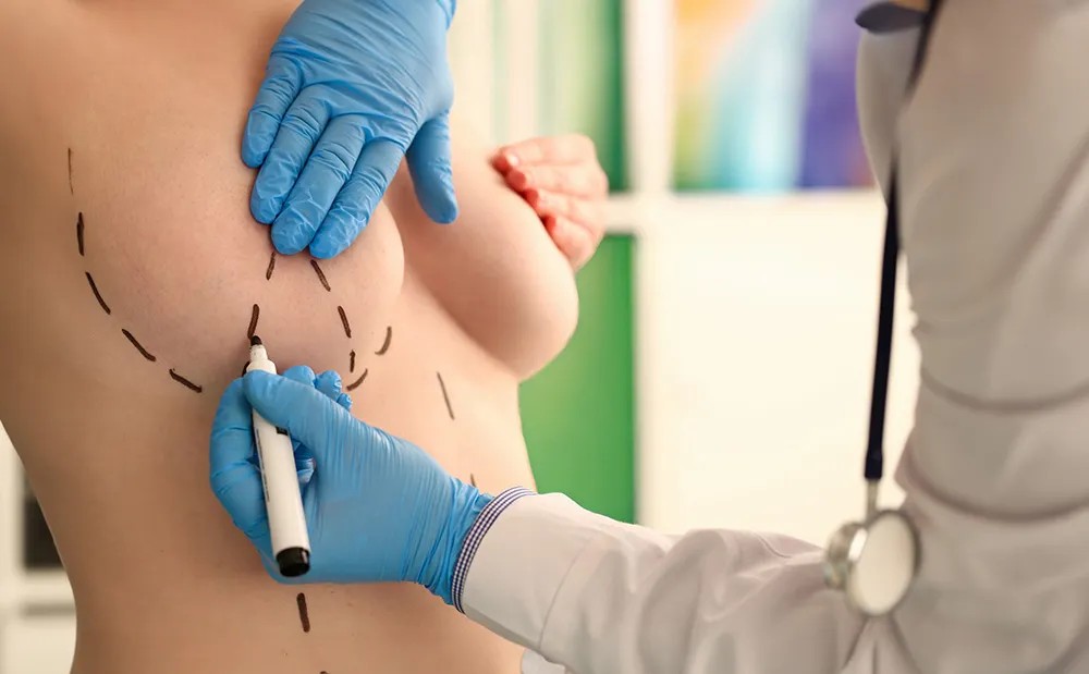 Breast Reduction